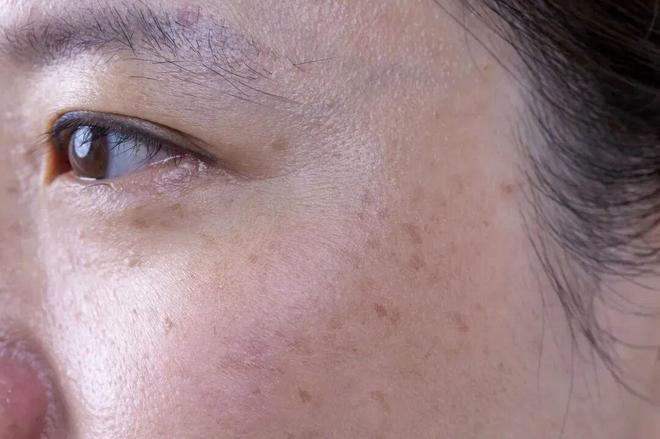 道我在雪场被晒得很曼妙CQ9电子中国网站不知(图3)